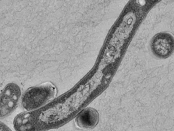 - © SYMBOLFOTO: DPA