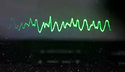 Gefahr durch Defibrillatoren

in Rettungswagen - &copy; OWL