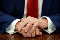US-Präsident Donald Trumps Hände nach der Unterzeichnung von Anordnungen im Oval Office des Weißen Hauses. - © Evan Vucci/AP/dpa