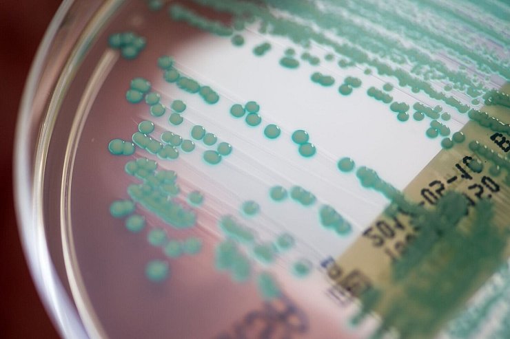 Die Zahl der Todesfälle, bei denen multiresistente Keime eine Rolle spielen, könnte von 4,71 Millionen auf 8,22 Millionen steigen. (Archivbild) - © Armin Weigel/dpa