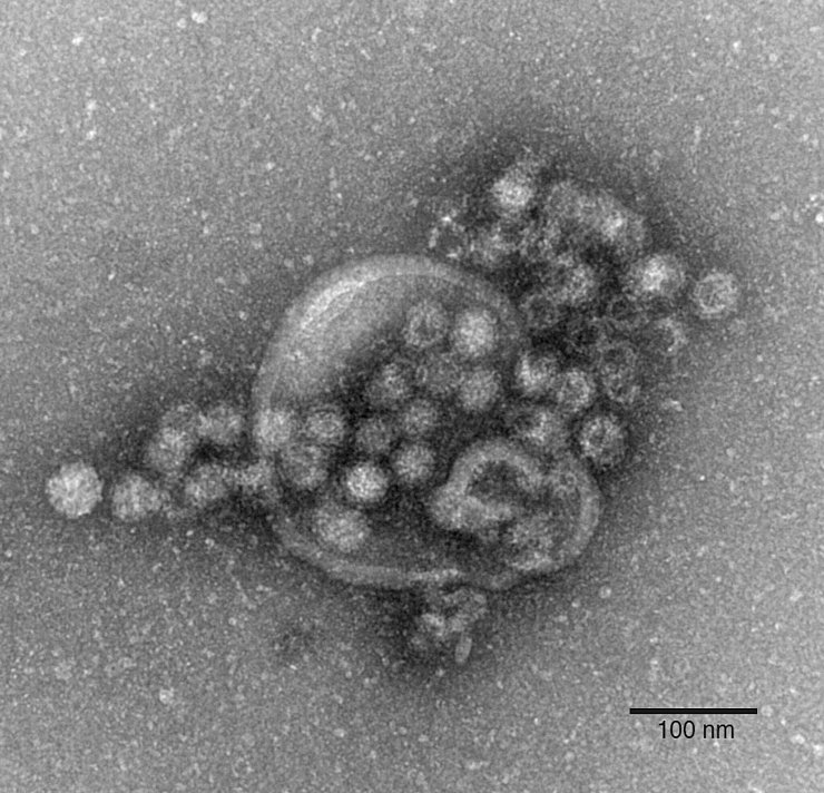 Das hochansteckende Norovirus verursacht einen plötzlich auftretenden, heftigen Brechdurchfall. - © Gudrun Holland/RKI/Robert-Koch-Institut/dpa