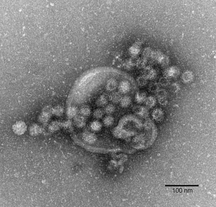 Das hochansteckende Norovirus verursacht einen plötzlich auftretenden, heftigen Brechdurchfall. (Archivbild) - © Gudrun Holland/RKI/Robert-Koch-Institut/dpa