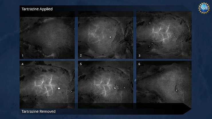Blutgefäße im Gehirn lassen sich mit der Farbstofflösung leicht sichtbar machen. - © Gail Rupert/NSF/Stanford University/dpa