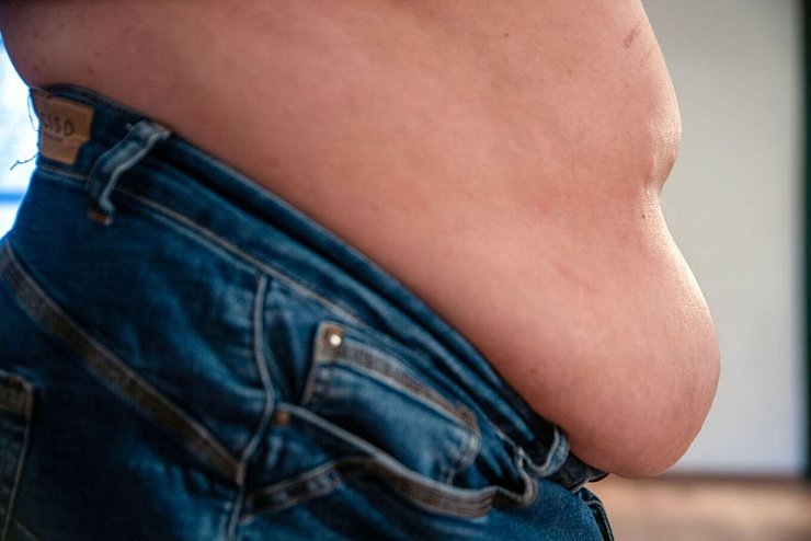 Übergewicht und Adipositas sind ein Gesundheitsrisiko. (Archivbild) - © Pia Bayer/dpa