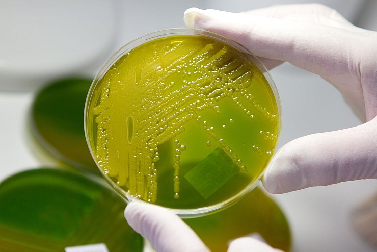 Ehec steht für enterohämorrhagische Escherichia coli und bezeichnet bestimmte krankmachende Stämme des Darm-Bakteriums, die vor allem bei Wiederkäuern wie Rindern vorkommen. (Archivbild) - © Matthias Bein/dpa-Zentralbild/dpa