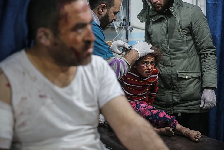 Das Foto des dpa-Fotografen Anas Alkharboutli zeigt ein verletztes sechsjähriges Mädchen. - © Anas Alkharboutli/dpa