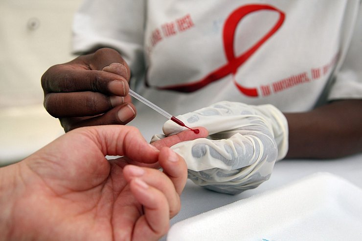 Blutabnahme für einen HIV-Test in einer südafrikanischen Klinik (Archivbild) - © picture alliance / dpa
