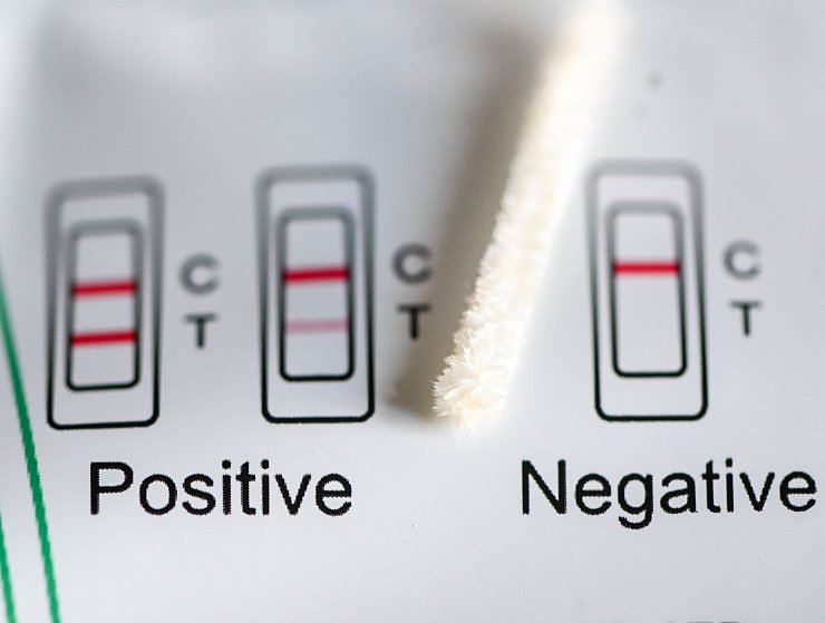 Positiv oder negativ - das zeigt ein Test an. (Symbolbild) - © Jens Kalaene/dpa