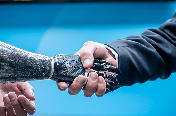 Während in den reichsten Ländern 88 Prozent der Menschen mit Behinderung Hilfsmittel wie etwa Prothesen, Rollstühle oder Hörgeräte nutzen können, sind es in den ärmsten Ländern nur 11 Prozent. - © Michael Kappeler/dpa