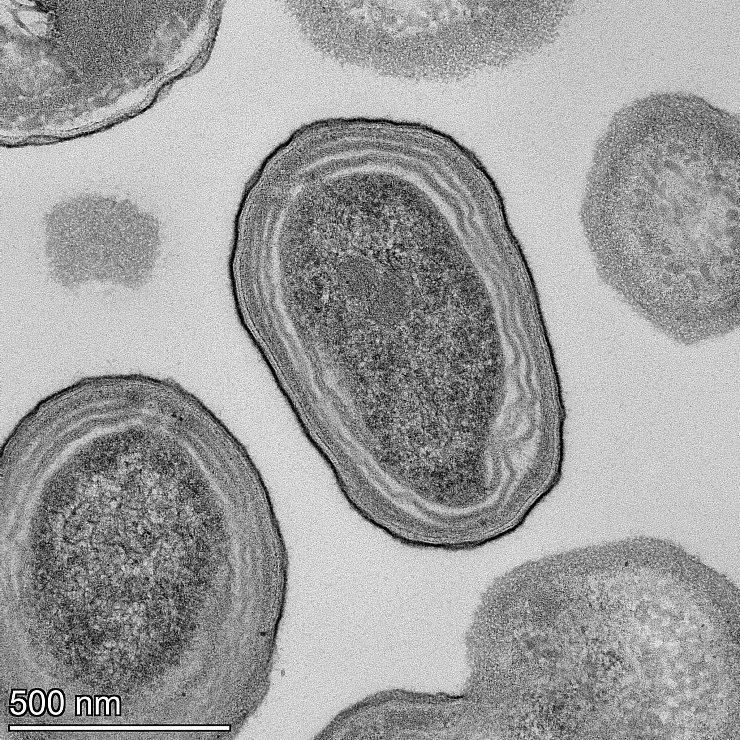 Elektronenmikroskopische Aufnahme von Prochlorococcus-Zellen. - © Natalie Kellogg/dpa