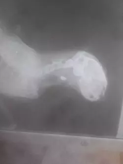 Das R&ouml;ntgenbild zeigt das Projektil. - &copy; pr