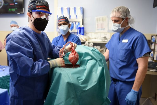 Im Jahr 2022 erhielt ein Mann in den USA ein Schweineherz. (Archivbild) - © Tom Jemski/University of Maryland School of Medicine/dpa