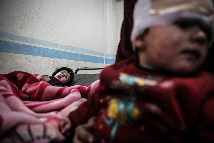 Verwundete Kinder - &copy; Foto: Anas Alkharboutli/dpa