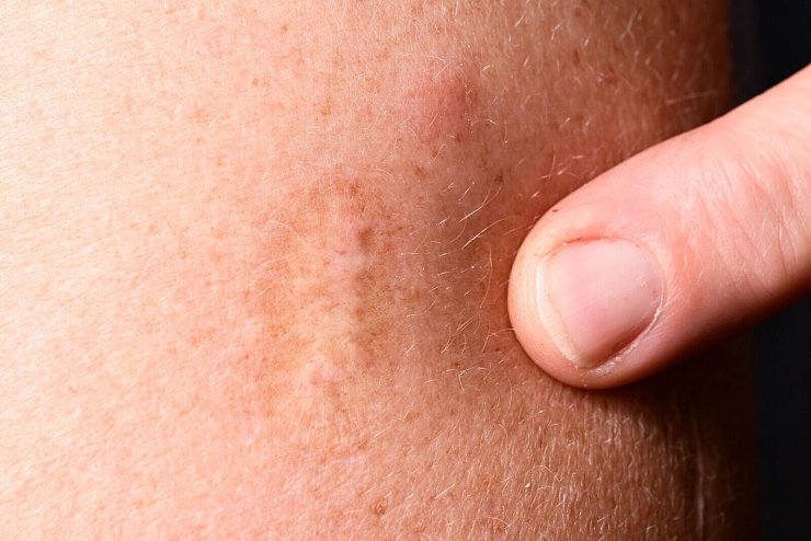 - &copy; Bernd Wei&szlig;brod/dpa