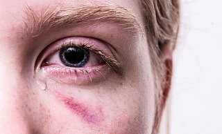 Ein Trauma kann die Seele lange belasten. - Symbolbild: Pixabay Ein Trauma kann die Seele lange belasten. - Symbolbild: Pixabay