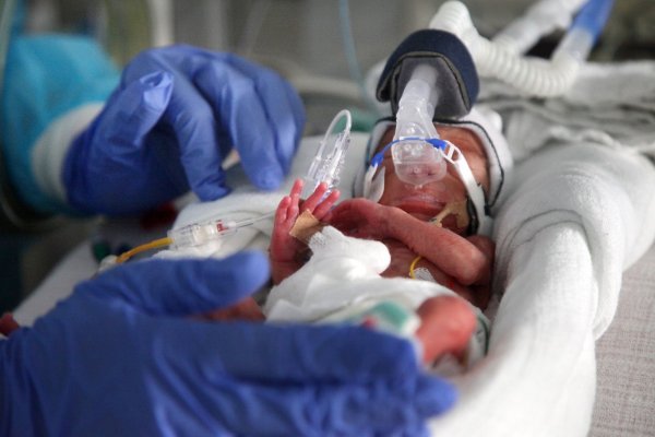 Intensiv versorgt: Ein Frühgeborenes Kind auf der Intensivstation der Familienklinik. - © Bernhard Preuss