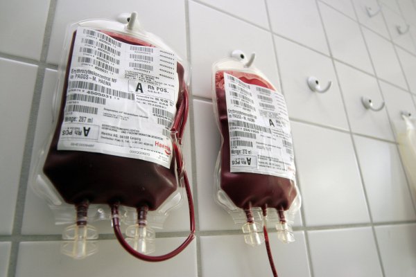 Verschiedene Genanalysen zeigen:Wie schwer ein Mensch an Covid-19 erkrankt, hängt offenbar auch mitseiner Blutgruppe zusammen. - © picture-alliance