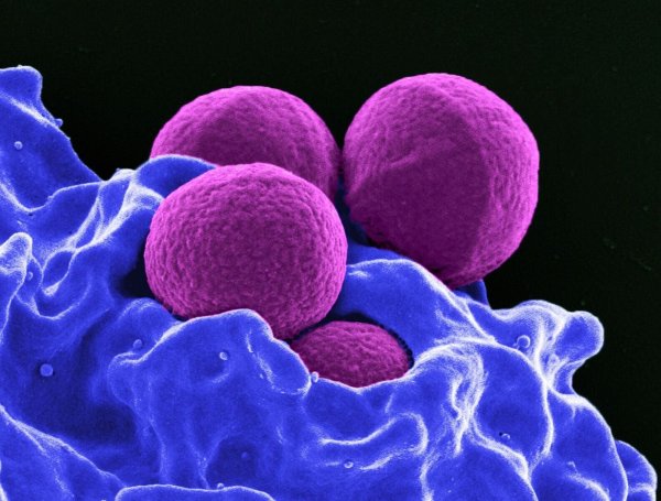 Jede Anwendung kann zur Vermehrung resistenter Bakterien führen, da diese dann einen Überlebensvorteil haben. (Archivbild) - © -/National Institute of Allergy and Infectious Diseases (NIAID)/dpa
