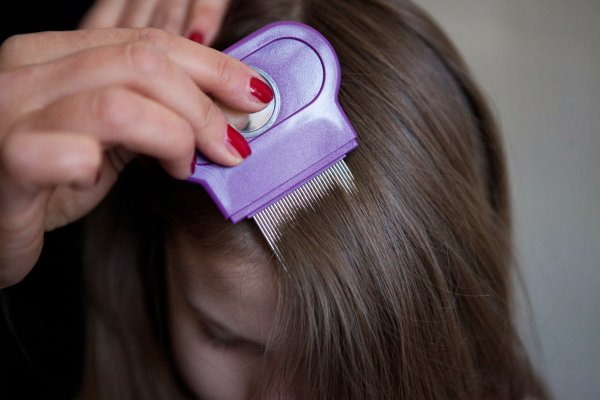 Lästig, aber ungefährlich: Kopfläuse wird man am besten mit Haarpflegespülung und einem Läusekamm los. - © Silvia Marks/dpa-tmn