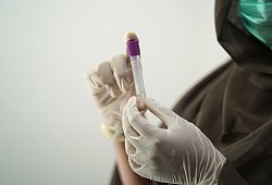 Der Kreis meldet 88 Neuinfektionen. - Pixabay