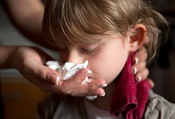 Ein Kind mit Nasenbluten hat Handtuch im Nacken - Silvia Marks/dpa-tmn