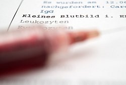Bluttest - picture alliance
