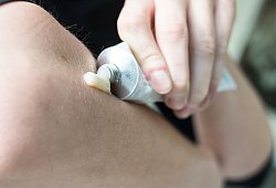Cortisonhaltige Salbe - 1 - picture alliance/dpa