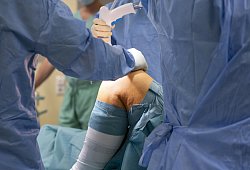 Knie-Operation - 1 - picture alliance / dpa Themendienst