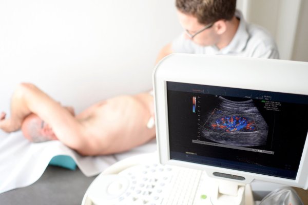 Ein Mediziner untersucht die Niere eines Patienten mit einem Ultraschallgerät - © Maurizio Gambarini/dpa