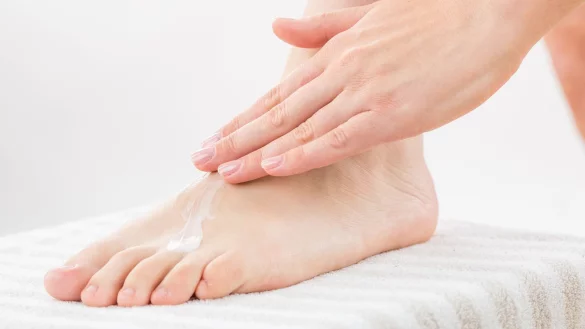 Jetzt im Sommer zeigt sich, wer Zeit in seine Fu&szlig;pflege steckt. Denn flei&szlig;iges Cremen mit Fu&szlig;balsam kann daf&uuml;r sorgen, dass man weniger Hornhaut bildet. - &copy; Christin Klose/dpa-tmn