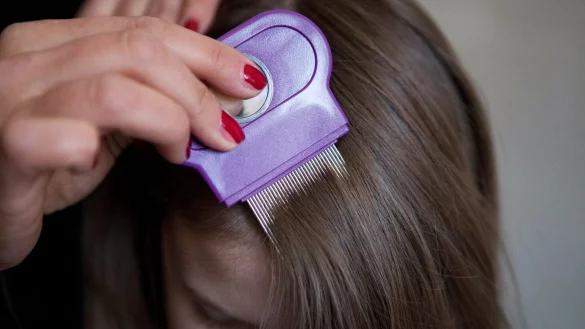 Kopfl&auml;use sind nicht gef&auml;hrlich, aber unangenehm. Los wird man sie mit L&auml;usemittel aus der Apotheke und einem Kamm mit feinen Zinken. - &copy; Silvia Marks/dpa-tmn