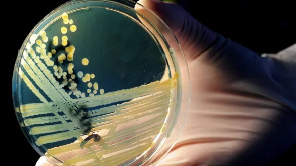 Vom Verzehr eines verunreinigten Lebensmittels bis zum Ausbruch der Erkrankung dauert es im Durchschnitt drei bis vier Tage (Archivbild) - © Julian Stratenschulte/dpa