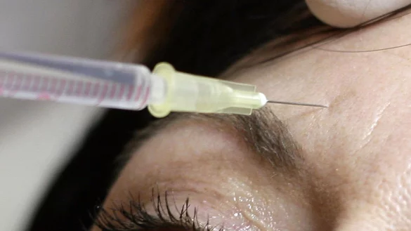 Am BGH geht es um sogenannte minimalinvasive Schönheitsbehandlungen. (Symbolbild) - © Peer Grimm/dpa-Zentralbild/dpa