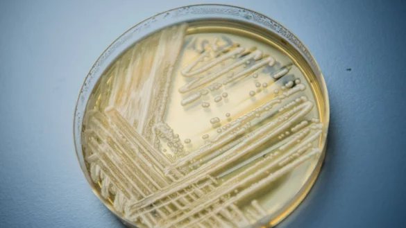 Der Hefepilz Candidozyma auris (fr&uuml;her bekannt als Candida auris). - &copy; Nicolas Armer/dpa