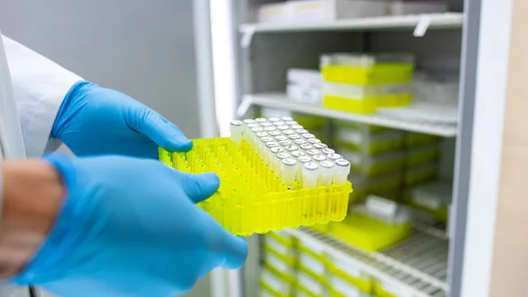 Ehec steht für enterohämorrhagische Escherichia coli und bezeichnet bestimmte krankmachende Stämme dieses im Darm vorkommenden Bakteriums. - © Guido Kirchner/dpa