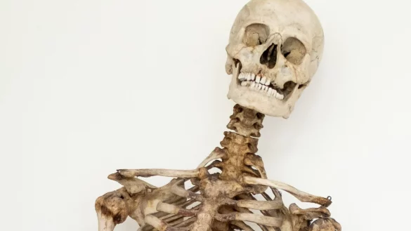 Dank wissenschaftlicher Analysen und eines Verwandten wei&szlig; man nun, dass dieses Skelett die sterblichen &Uuml;berreste des R&auml;ubers Schinderhannes sind. - &copy; Sara Doll/Medizinische Fakult&auml;t Heidelberg/dpa