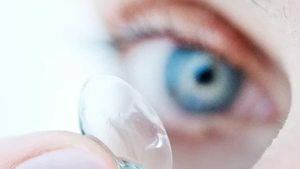 Mit der richtigen Wahl der Kontaktlinsen kommen Allergikerinnen und Allergiker besser durch die Pollenzeit. - © Franziska Gabbert/dpa-tmn