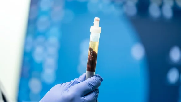 In Kalifornien konnte eine Pest-Infektion nachgewiesen werden - &copy; Silas Stein/dpa