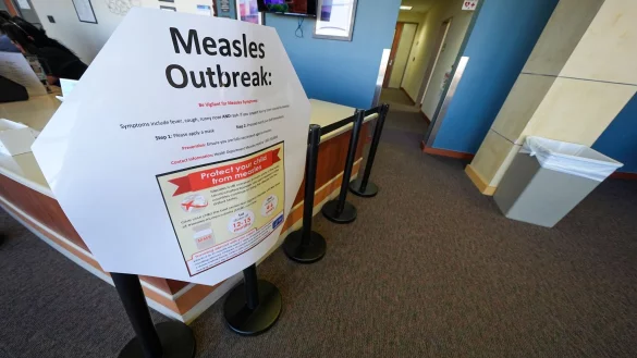 Die Masern breiten sich in den USA weiter aus. (Archivbild) - © Julio Cortez/AP/dpa