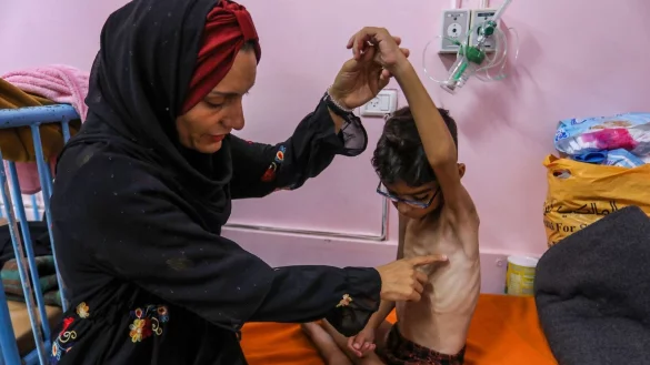 Kinder unter fünf Jahren sind bei Mangelernährung in Lebensgefahr. (Archivbild) - © Abed Rahim Khatib/dpa