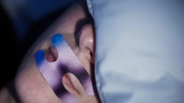 Mund-Zukleben: Ein kanadisches Forschungsteam mahnt zur Vorsicht. (Illustration) - &copy; Christoph Soeder/dpa