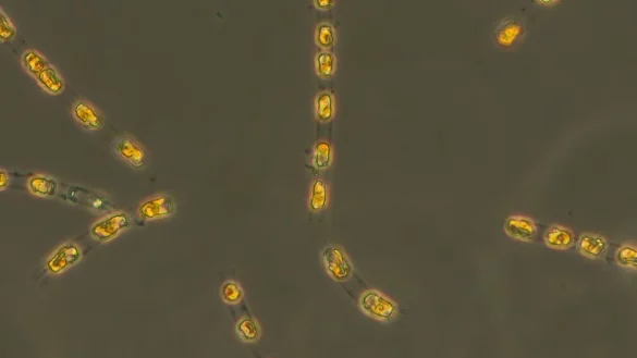 Die Kieselalge Skeletonema marinoi ist nach 7000 Jahren in einem Dauerzustand auf dem Meeresgrund nun wieder aktiv. - &copy; S. Bolius/Iow/dpa