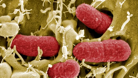 Die Quelle der aktuellen Infektionen ist in keinem der Fälle bekannt. (Archivbild) - © Manfred Rohde/HZI/HZI/dpa