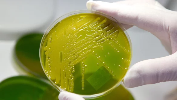 In Zwiebelmettwurst wurden die Bakterien nachgewiesen. (Archivbild) - © Matthias Bein/dpa-Zentralbild/dpa