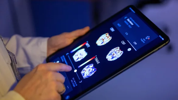 Gehirnbilder eines Patienten in einer KI-basierten App. Nach einer Deloitte-Umfrage sehen viele B&uuml;rgerinnen und B&uuml;rger den Einsatz von KI in der Medizin skeptisch, vor allem wenn es um die Therapie geht. (Symbolbild) - &copy; Monika Skolimowska/dpa