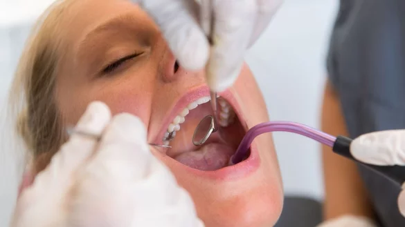 Rau, verdickt, verhärtet: Erkennt der Zahnarzt eine Veränderung der Mundschleimhaut frühzeitig, verbessert das die Heilungschancen, sollte es sich dabei um Krebs handeln. - © Benjamin Nolte/dpa-tmn