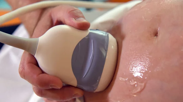 Die russische Region Orjol will Schwangerschaften bei Sch&uuml;lerinnen mit einer Pr&auml;mie unterst&uuml;tzen (Archivbild) - &copy; Waltraud Grubitzsch/dpa