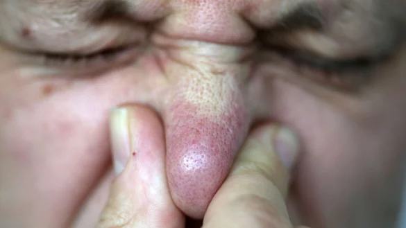 Ein Flug in der Economy-Klasse kann neben einem Viel-Pupser zur Herausforderung werden (Archivbild) - &copy; Oliver Berg/dpa