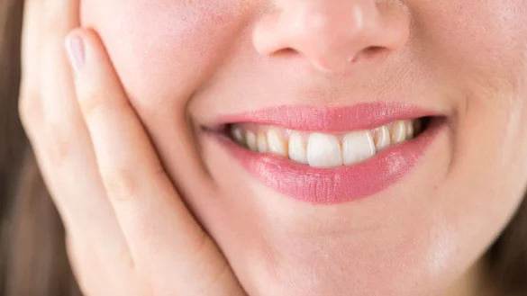 Strahlendes Lächeln: Gründliches Zähneputzen mit Scheuerstoffen und elektrischen Zahnbürsten hilft, Verfärbungen vorzubeugen. - © Christin Klose/dpa-tmn