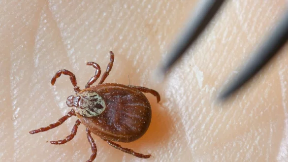 Im Jahr 2024 waren 686 FSME-Erkrankungen gemeldet worden - die zweithöchste Zahl seit Beginn der Datenerfassung im Jahr 2001. (Archivbild) - © Patrick Pleul/dpa-Zentralbild/dpa